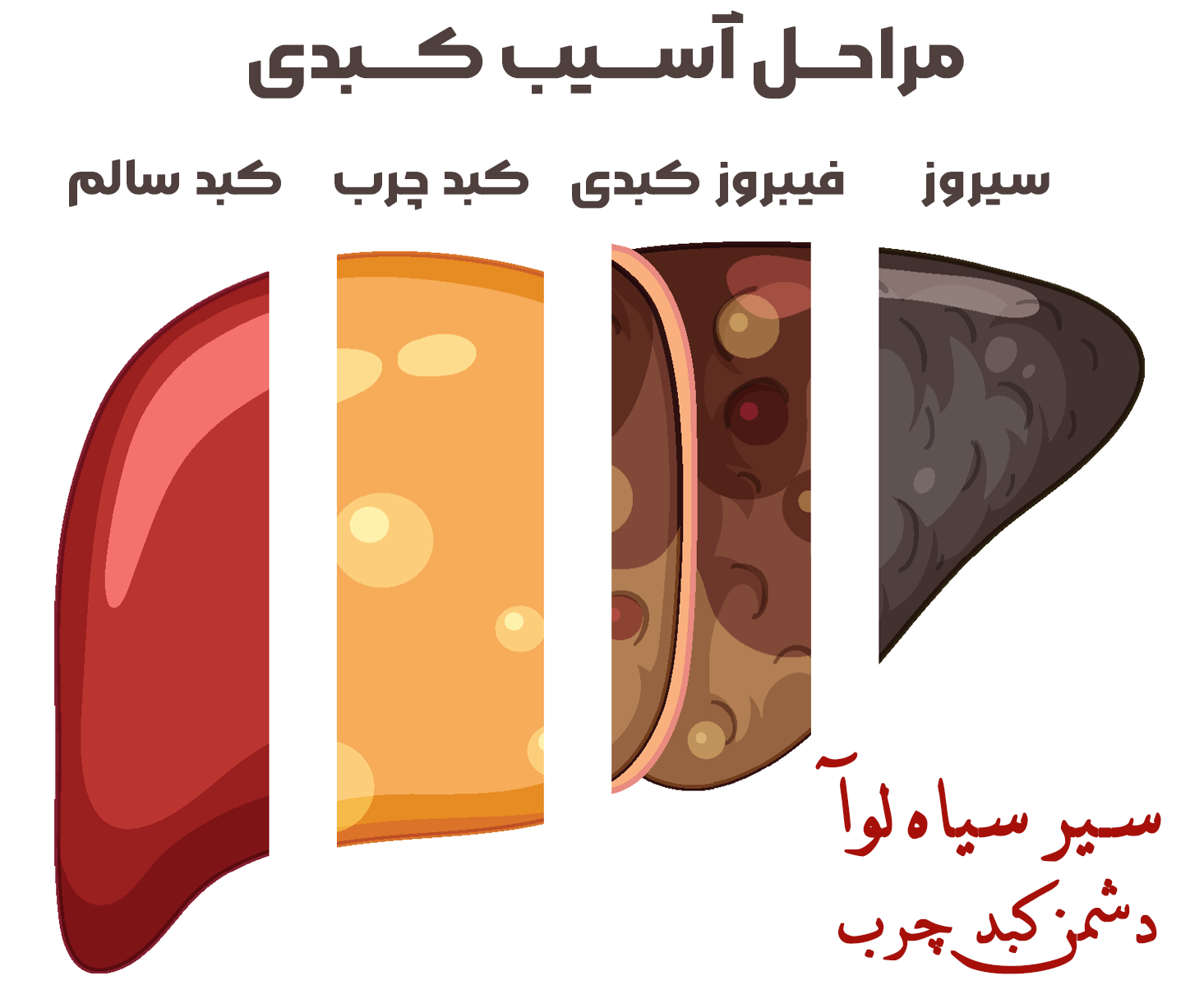 درمان کبد چرب با سیر سیاه لوآ