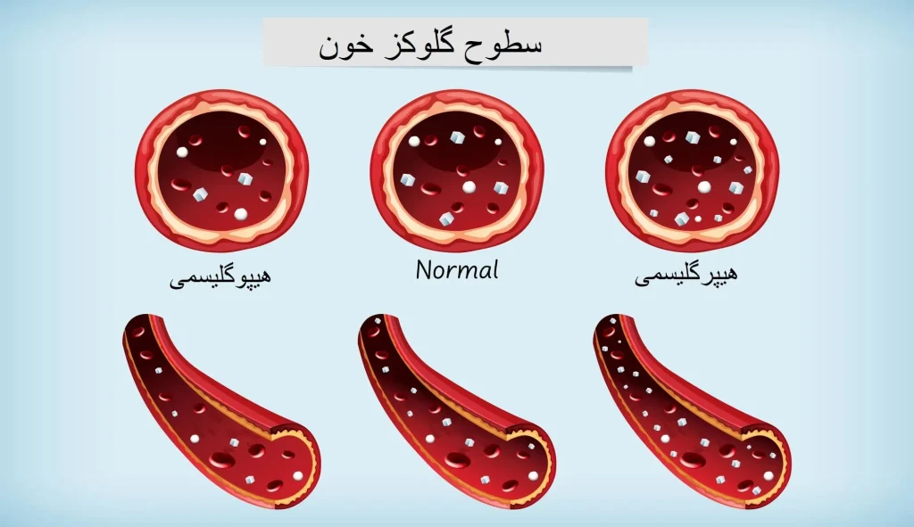 درمان چربی خون ( این بیماری) با روش های خانگی 